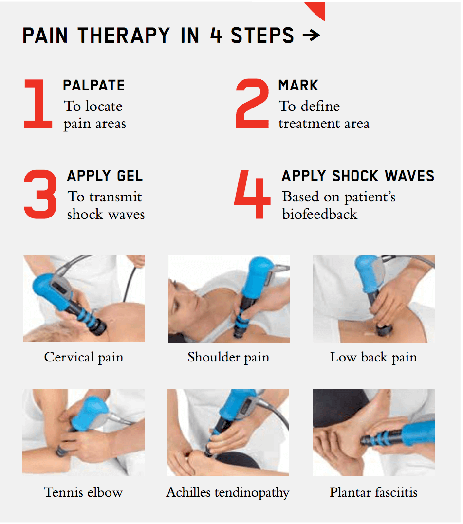 shockwave-therapy-lakky-physiotherapy