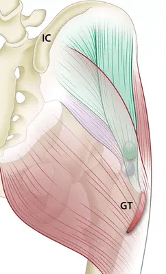 greater-trochanter