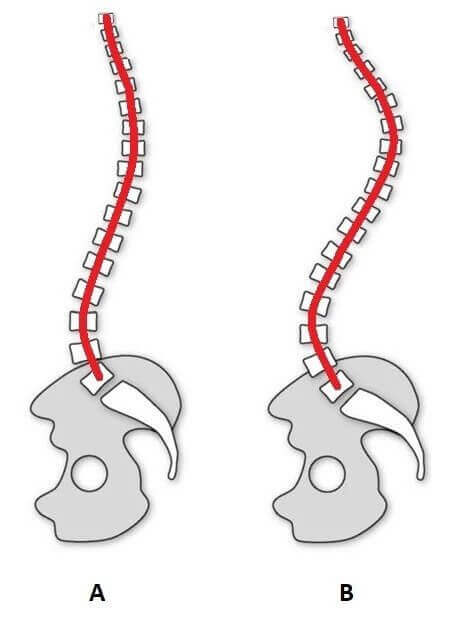 upperback-neck-curvatures